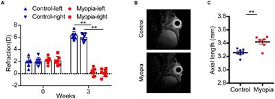 Gut microbiome and plasma metabolome alterations in myopic mice